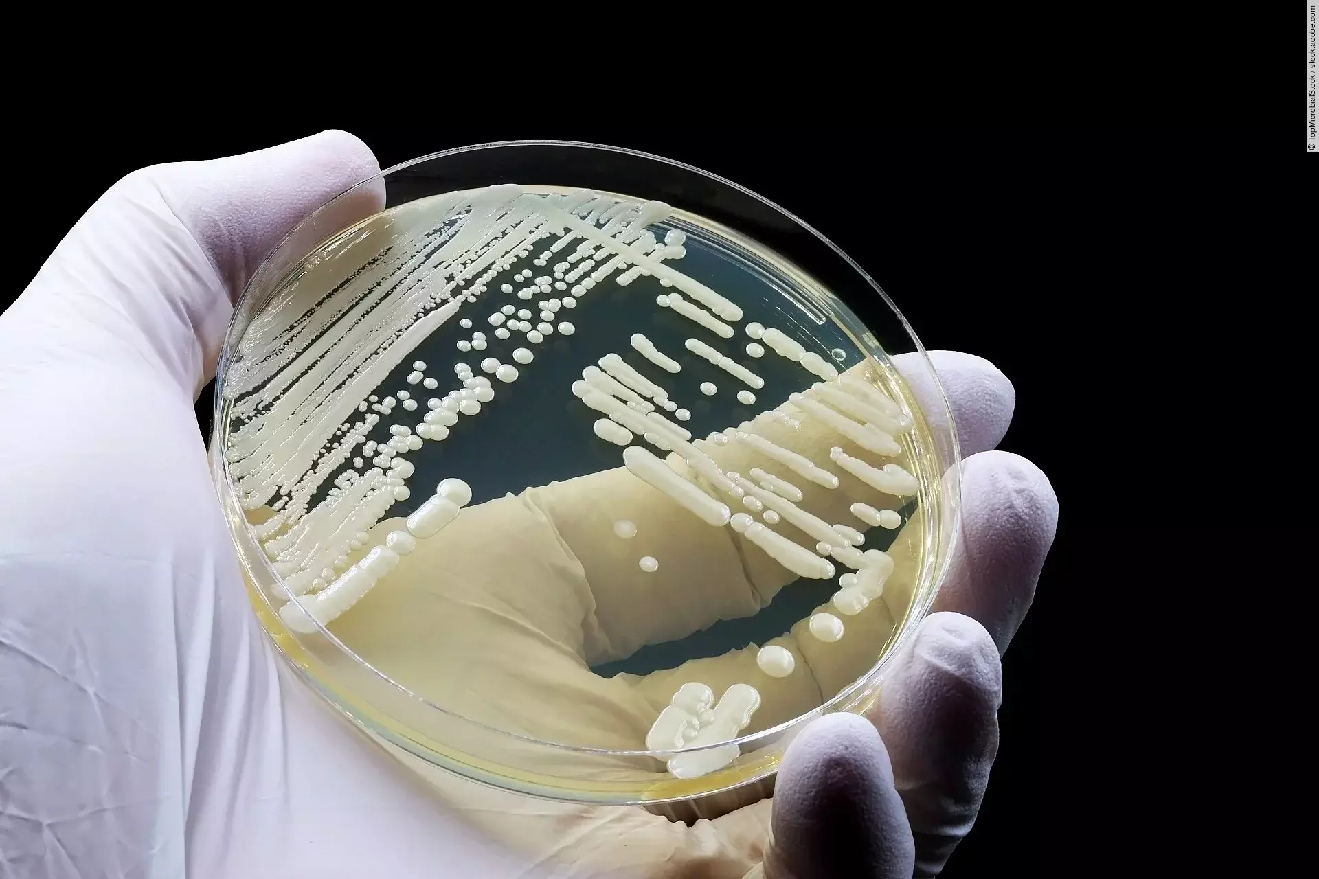 Eine Petrischale wird einer Hand mit Handschuhen gehalten.