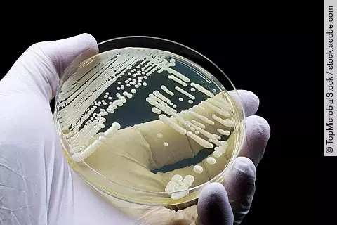 Eine Petrischale wird einer Hand mit Handschuhen gehalten.