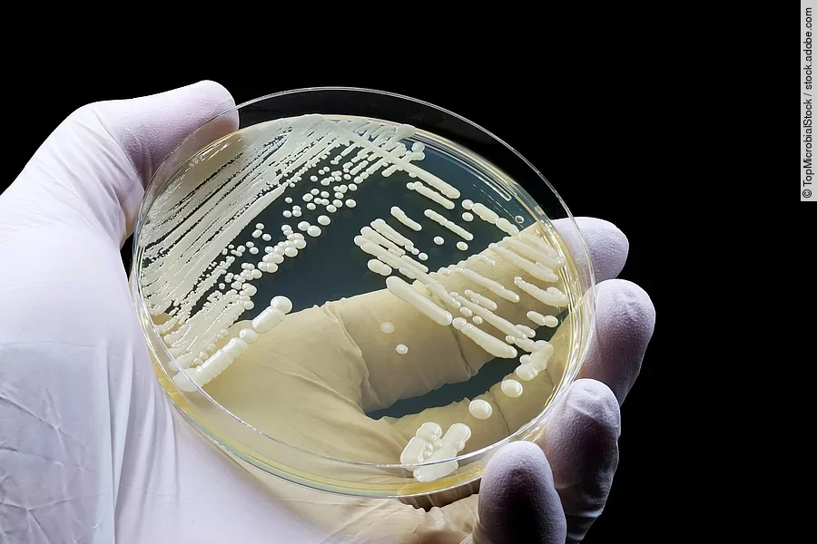 Eine Petrischale wird einer Hand mit Handschuhen gehalten.