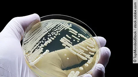 Eine Petrischale wird einer Hand mit Handschuhen gehalten.