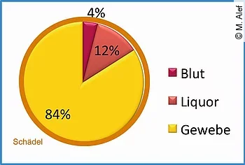Monro-Kellie-Doktrin