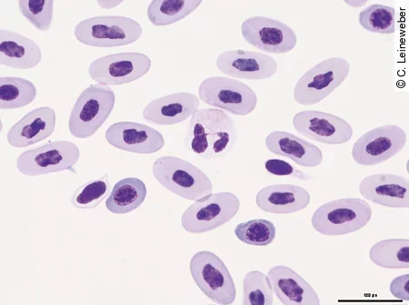 Im Diff-Quick gefärbten Blutausstrich eines Jemenchamäleons erkennt man einen heterophilen Granulozyt.