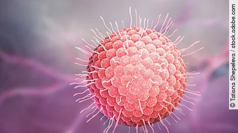 Varicella zoster virus
