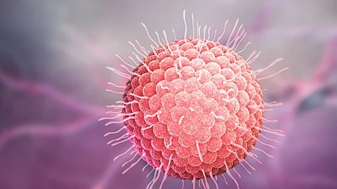 Varicella zoster virus