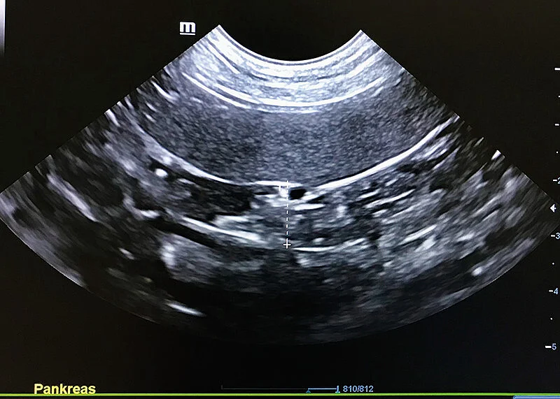 Ein sonografisches Bild des linken Pankreasschenkels. Ein sonografisches Bild des linken Pankreasschenkels.