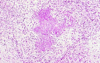 Histologisches Präparat 