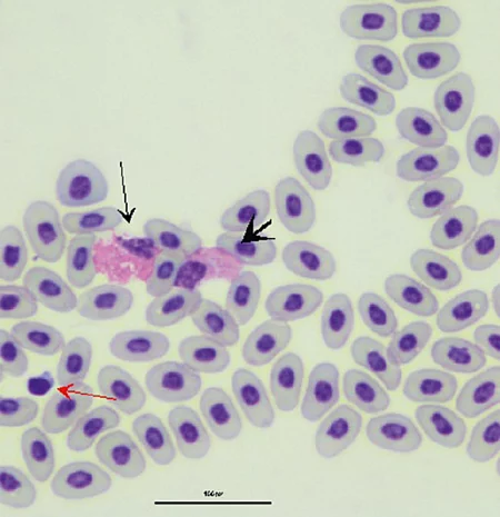 Im Blutausstrich einer Rotwangenschmuckschildkröte sieht man einen heterophilen Granulozyt, einen eosinophilen Granulozyt und einen Thrombozyt. Im Blutausstrich einer Rotwangenschmuckschildkröte sieht man einen heterophilen Granulozyt, einen eosinophilen Granulozyt und einen Thrombozyt.