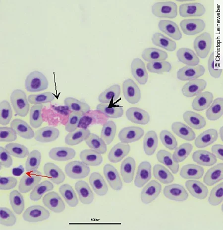Im Blutausstrich einer Rotwangenschmuckschildkröte sieht man einen heterophilen Granulozyt, einen eosinophilen Granulozyt und einen Thrombozyt.