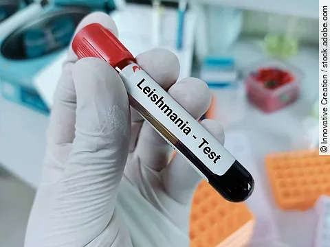 Blood sample for Leishmania parasite test, leishmaniasis. Medica