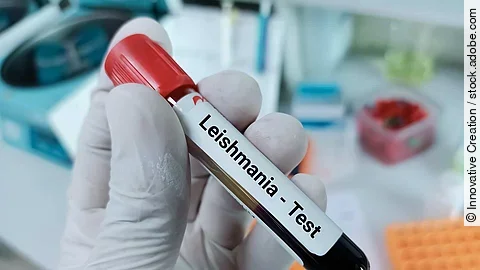 Blood sample for Leishmania parasite test, leishmaniasis. Medica