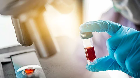lab technician assistant analyzing a blood sample in test tube a