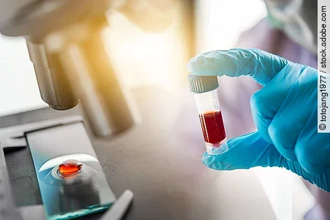 lab technician assistant analyzing a blood sample in test tube a