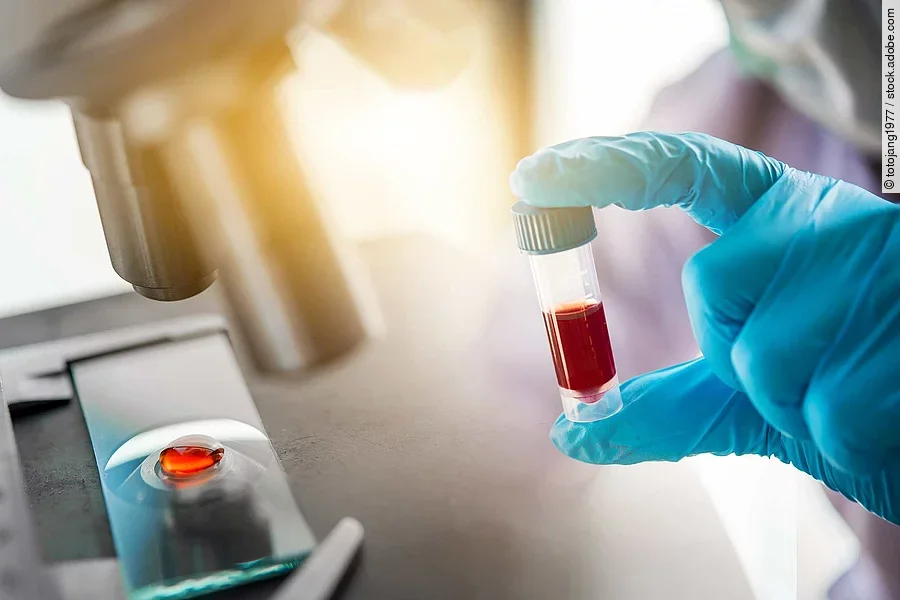 lab technician assistant analyzing a blood sample in test tube a
