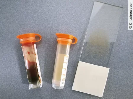 Für eine umfassende Blutuntersuchung braucht man einen Objektträger für einen Blutausstrich, ein Lithium-Heparin-Plasma Röhrchen und eins für Lithium-Heparin-Vollblut.