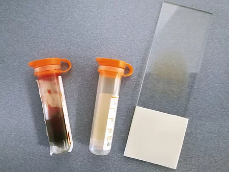 Für eine umfassende Blutuntersuchung braucht man einen Objektträger für einen Blutausstrich, ein Lithium-Heparin-Plasma Röhrchen und eins für Lithium-Heparin-Vollblut.