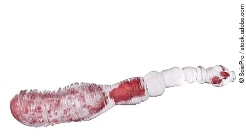 3d rendered medically accurate illustration of an echinococcus g