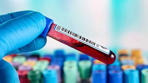 Blood sample for coagulation test in the laboratory