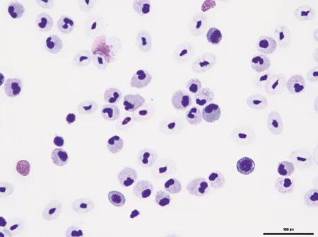 Im Blutausstrich einer Bartagame ist eine deutliche Leukozytose erkennbar.
