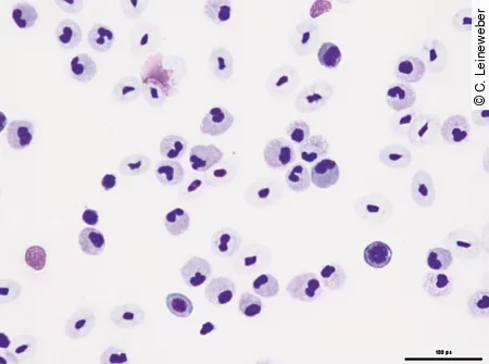 Im Blutausstrich einer Bartagame ist eine deutliche Leukozytose erkennbar.