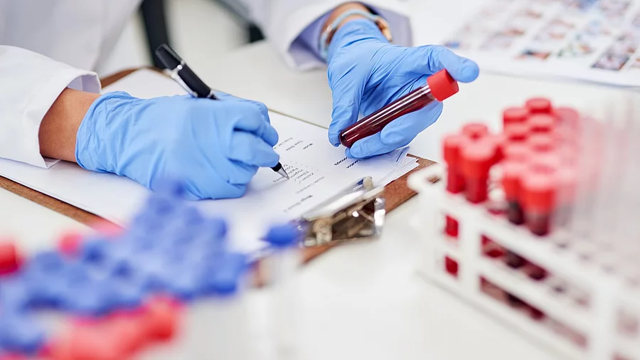 Nahaufnahme eines Wissenschaftlers, der eine Blutprobe untersucht und seine Ergebnisse in einem Labor protokolliert. In der linken Hand hält er ein Blutröhrechen und in der rechten einen Kugelschreiber. An den Händen sind blaue Einmalhandschuhe und auf dem Tisch stehen weitere Proben.