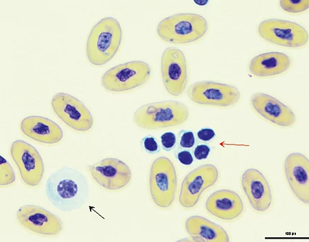 Im 1000-fach vergößerten Blutausstrich einer Schlange kann man Thrombozytenaggregate und einen Azurophilen erkennen.