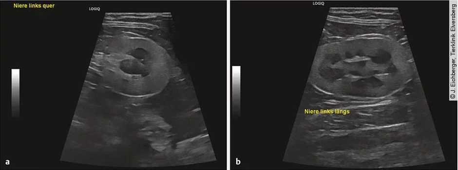 Ultraschalluntersuchung der Nieren