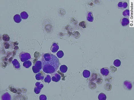Zytologische Untersuchung