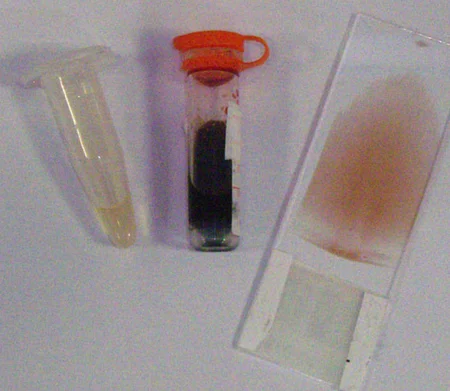 Für eine vollständige Blutuntersuchung einer Schildkröte benötigt man einen Blutausstrich, Lithium-Heparin-Plasma und Lithium-Heparin-Vollblut. Für eine vollständige Blutuntersuchung einer Schildkröte benötigt man einen Blutausstrich, Lithium-Heparin-Plasma und Lithium-Heparin-Vollblut.