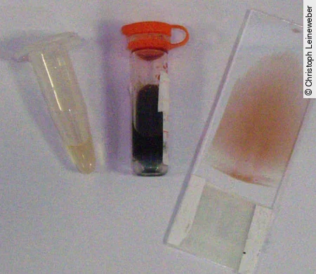 Für eine vollständige Blutuntersuchung einer Schildkröte benötigt man einen Blutausstrich, Lithium-Heparin-Plasma und Lithium-Heparin-Vollblut.