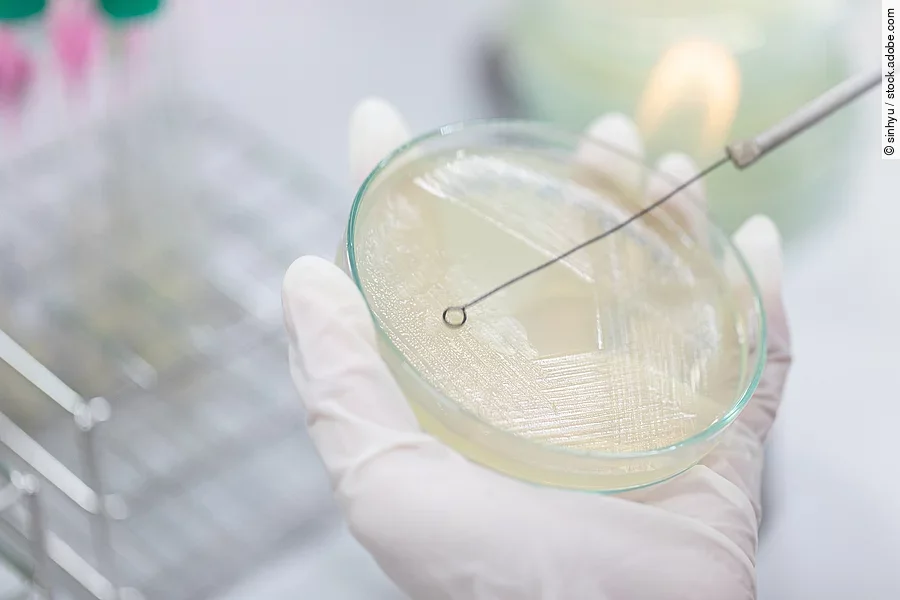 Streak plate for Bacteria culture or identify Bacteria research Petrischale mit einer Kultur.