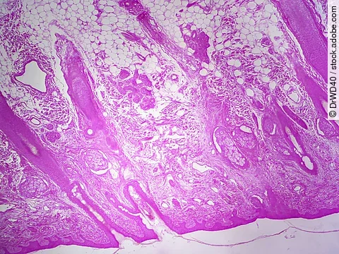 Haut unter dem Mikroskop