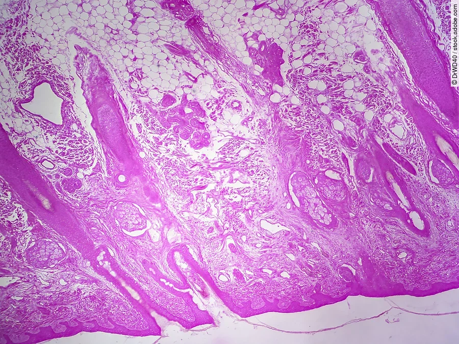 Haut unter dem Mikroskop