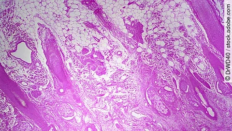 Haut unter dem Mikroskop