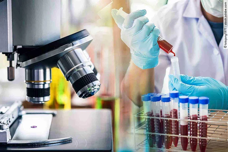 lab technician assistant analyzing a blood sample in test tube a