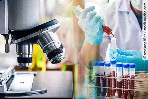 lab technician assistant analyzing a blood sample in test tube a