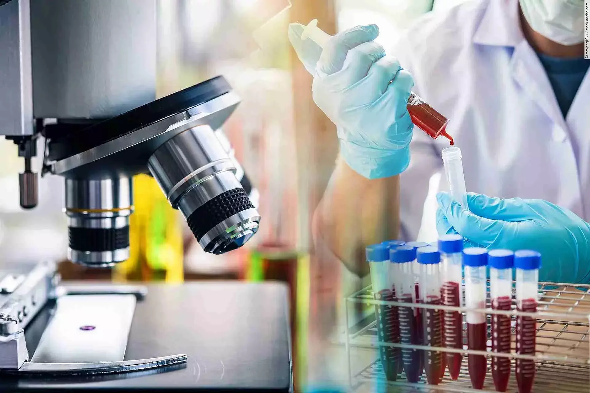 lab technician assistant analyzing a blood sample in test tube a