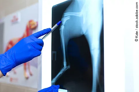 Auswertung eines Röntgenbildes