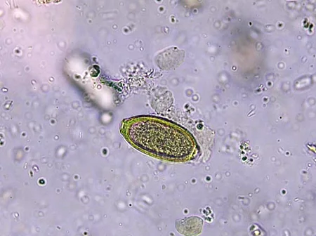 Unter dem Mikroskop sieht man ein Capillaria-Ei in 40facher Vergrößerung.