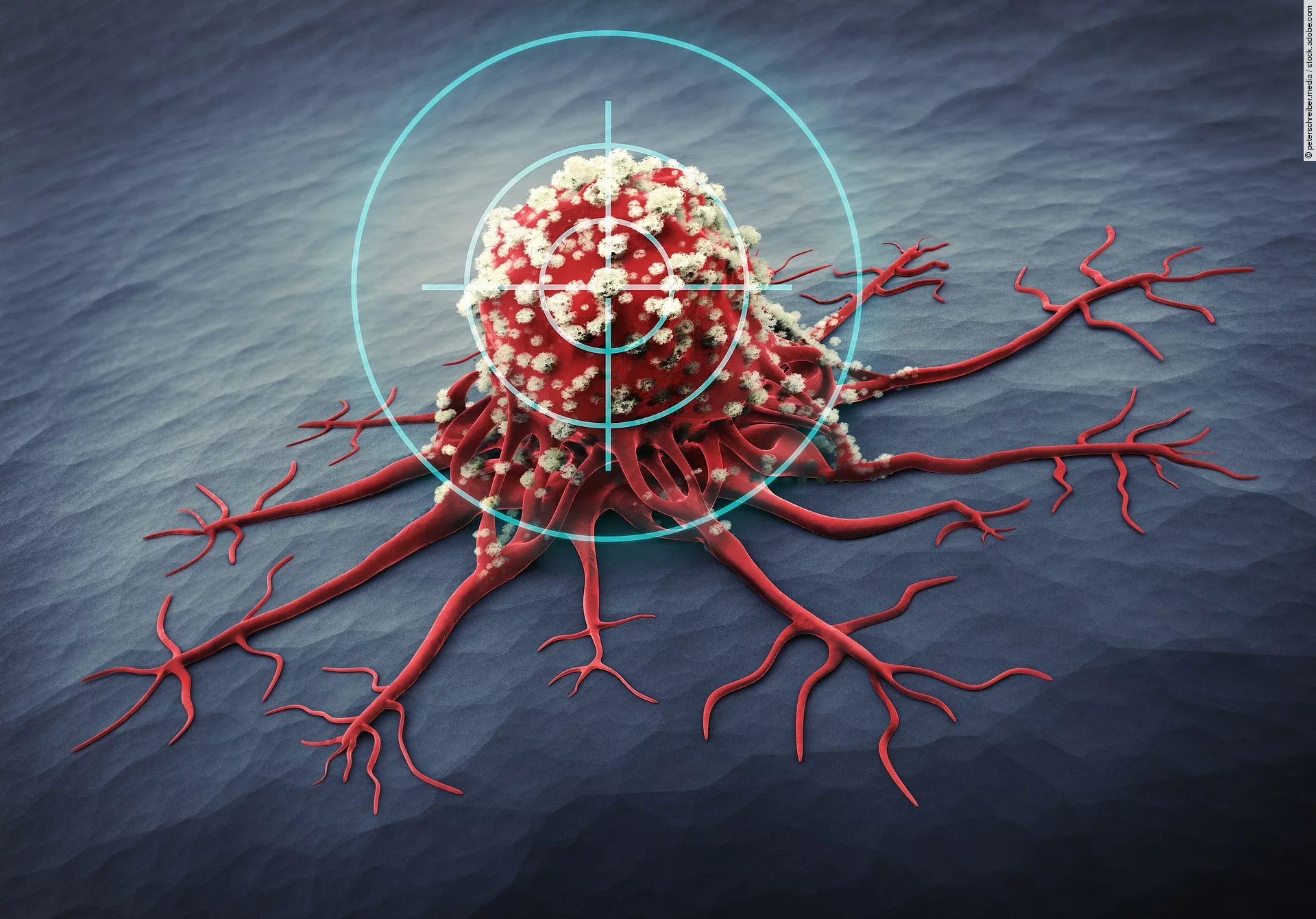 Eine Tumorzelle mit eigenen Gefäßen sitzt fest an der Haut und wird jetzt gezielt bekämpft.