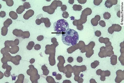 E.canis verdächtige Einschlüsse in einem Monozyten