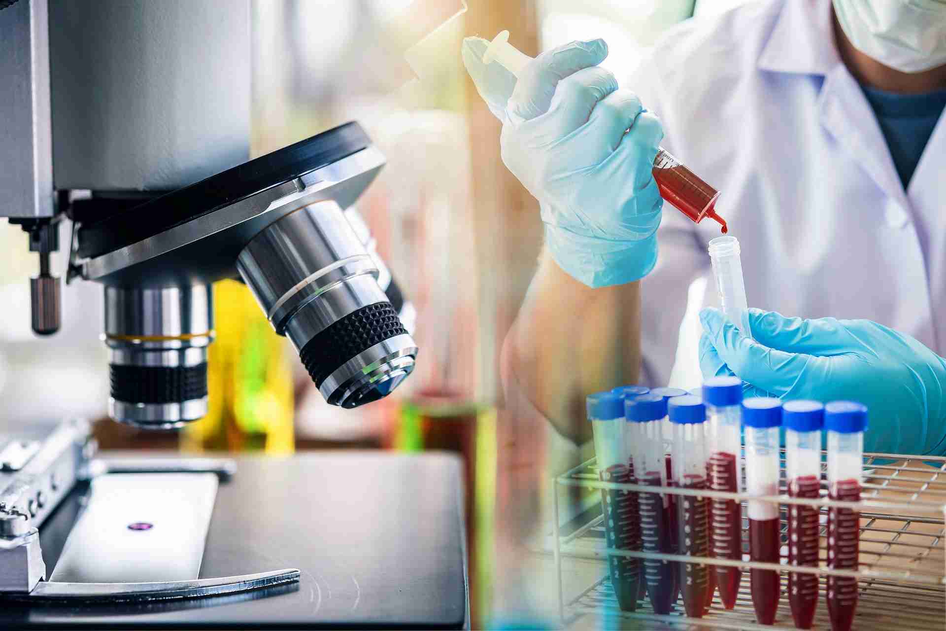 lab technician assistant analyzing a blood sample in test tube a
