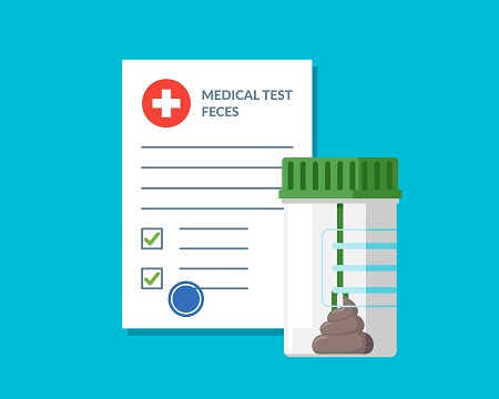 Plastic jar stool feces test analysis and medical form list with