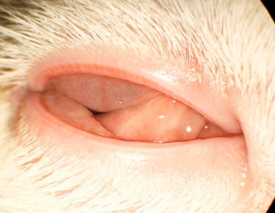 Ausgeprägte Chemosis