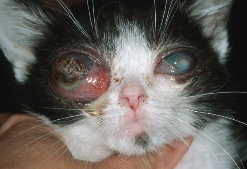 Pyophthalmus und Sekundärglaukom