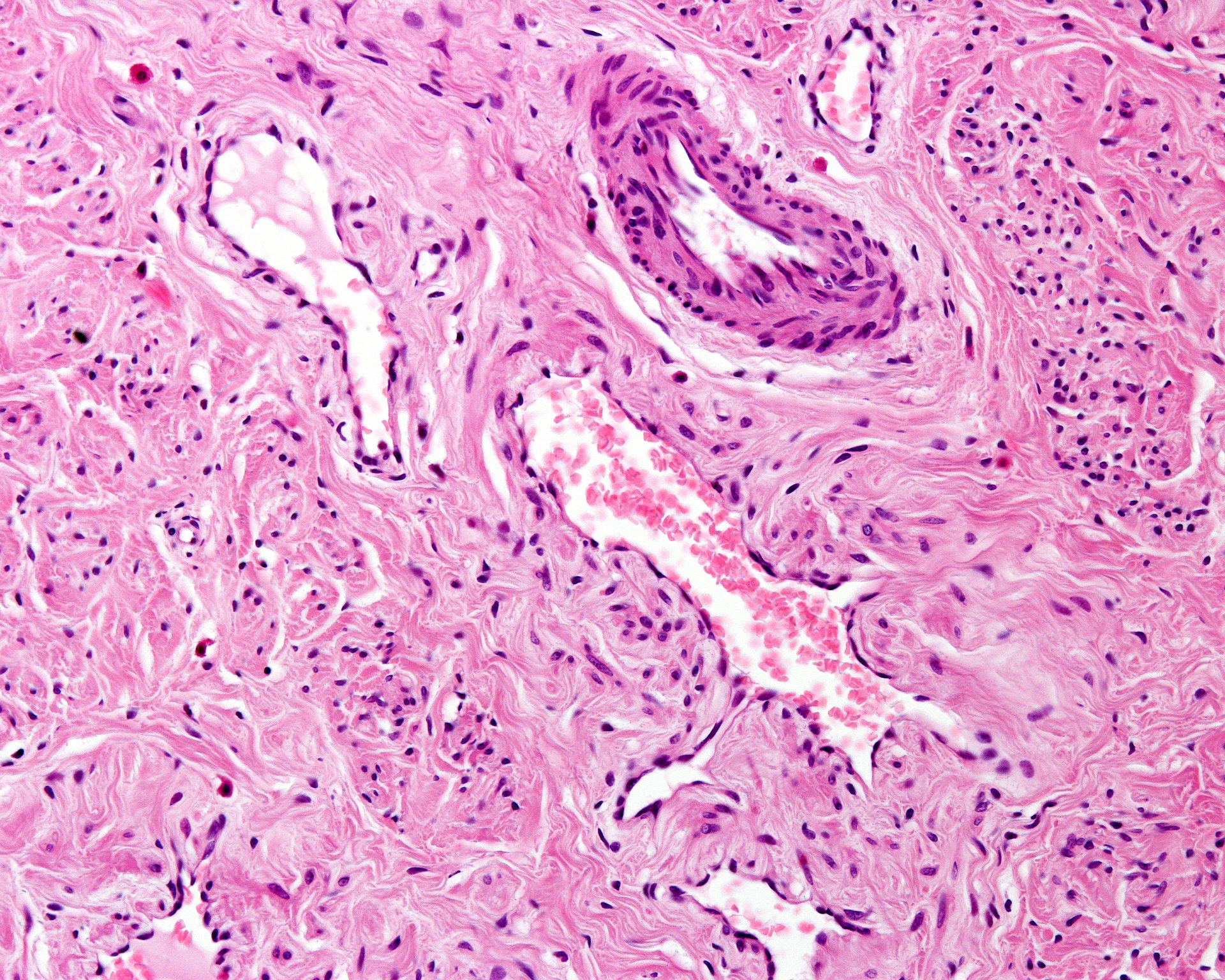 Eine histologische Abbildung von Bindegewebe.