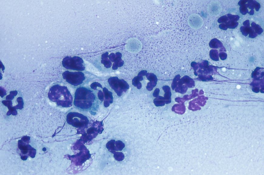 Zytologisches Präparat